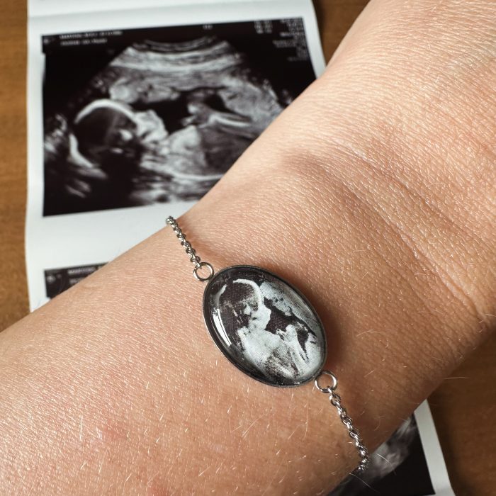 Armbandje met echo foto - cadeau zwangerschap